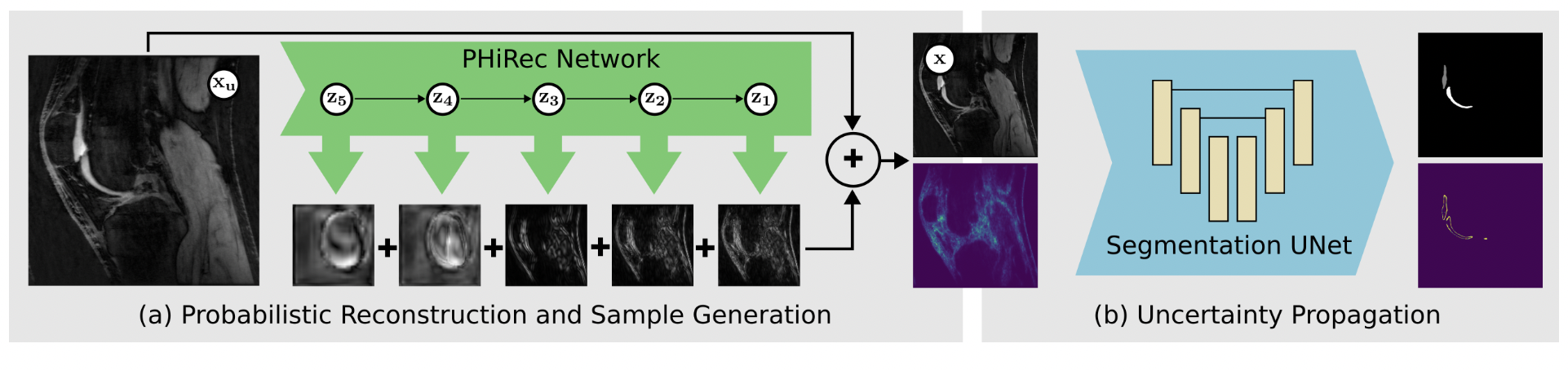 Uncertainty Estimation and Propagation in Accelerated MRI Reconstruction